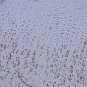 성장 호르몬 투여 세포